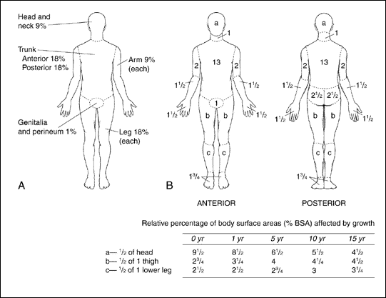 Estimating Percent Total Body Surface Area Affected by Burns